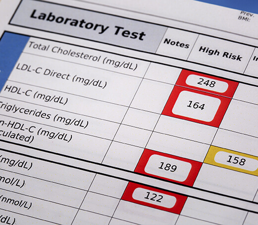 Cholesterol